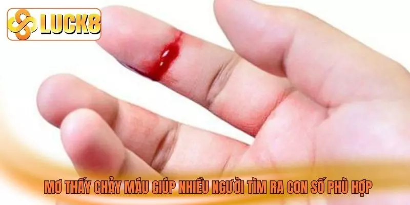 Mơ thấy chảy máu giúp nhiều người tìm ra con số phù hợp Mơ thấy chảy máu giúp nhiều người tìm ra con số phù hợp