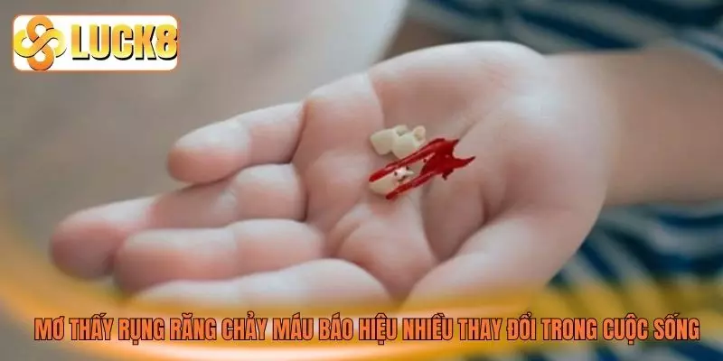 Mơ thấy rụng răng chảy máu báo hiệu nhiều thay đổi trong cuộc sống Mơ thấy rụng răng chảy máu báo hiệu nhiều thay đổi trong cuộc sống